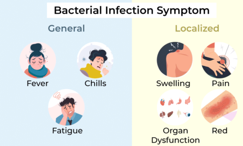 What is the primary treatment for bacterial infections?