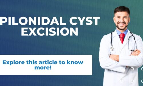 Psychological Impact of Pilonidal Cysts and Their Treatment